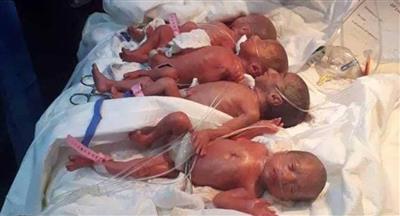 عراقية تضع 7 توائم في «ولادة طبيعية» نادرة